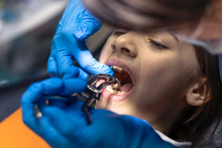 Aperfeiçoamento Cirurgia Oral Menor e Estomatologia bn