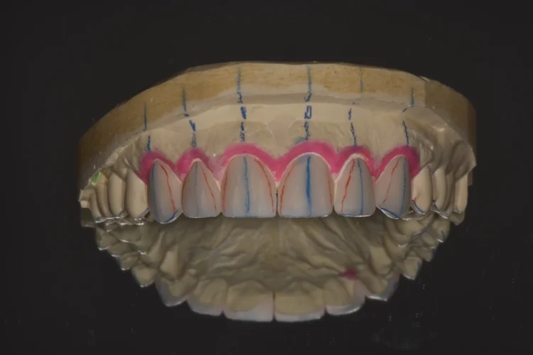 Especialização Implantodontia e Prótese Dentária